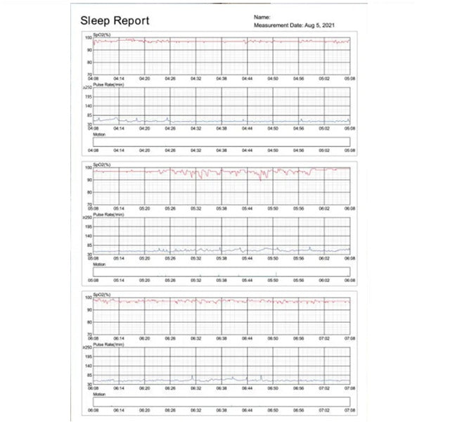 Viatom® Bluetooth-Finger-Pulsoximeter zur Überwachung von SpO₂ und Herzfrequenz