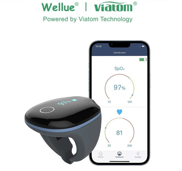 Viatom® O2Ring – Anello per il monitoraggio continuo di SpO₂ e frequenza cardiaca