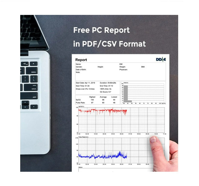 Viatom® O2Ring – Anello per il monitoraggio continuo di SpO₂ e frequenza cardiaca