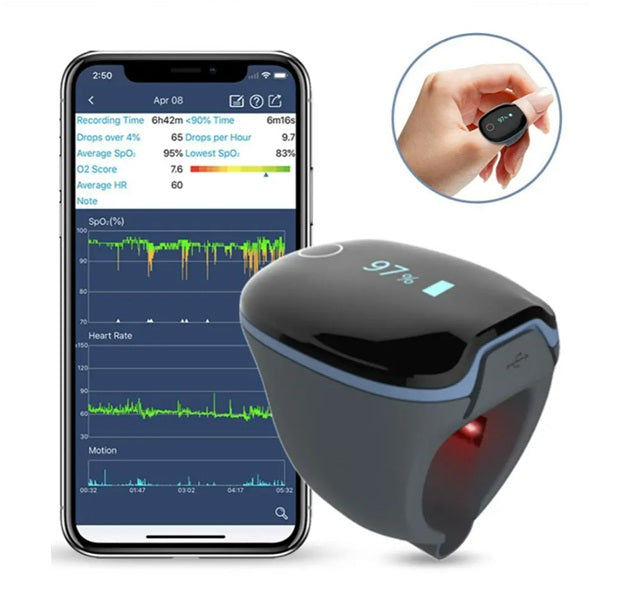 Viatom® O2Ring – Anello per il monitoraggio continuo di SpO₂ e frequenza cardiaca
