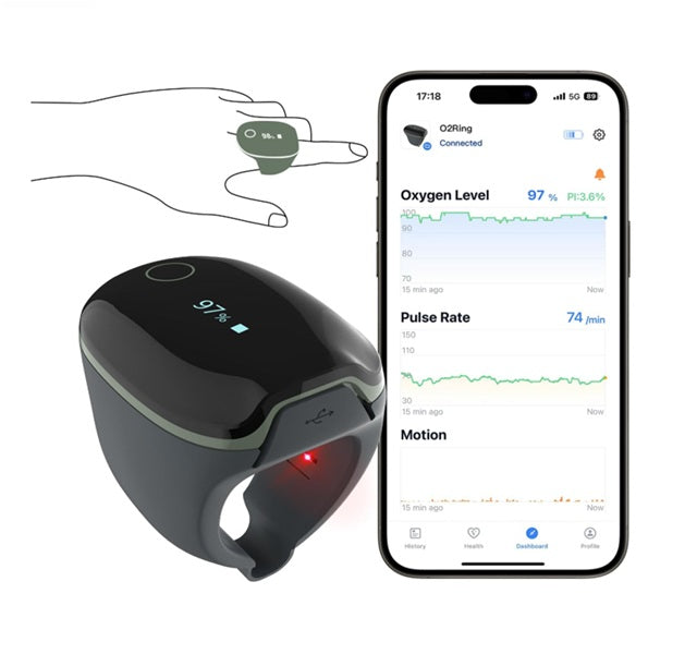 Viatom® O2Ring – Anello per il monitoraggio continuo di SpO₂ e frequenza cardiaca