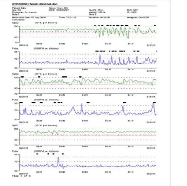 nVision Logiciel de gestion des données SpO2