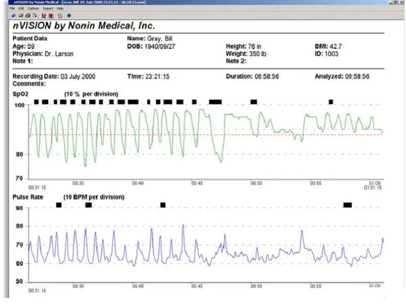 nVision Logiciel de gestion des données SpO2